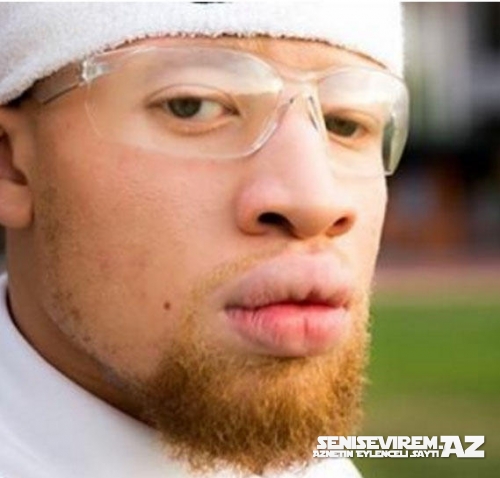 13 məşhur albinos model sekilleri