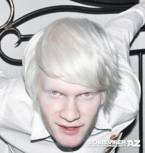 13 məşhur albinos model sekilleri